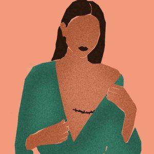 téva/ «Mes seins ne me tueront pas» : Marianne Tavennec, porteuse du gène BRCA à haut risque de développer un cancer du sein, partage son expérience personnelle