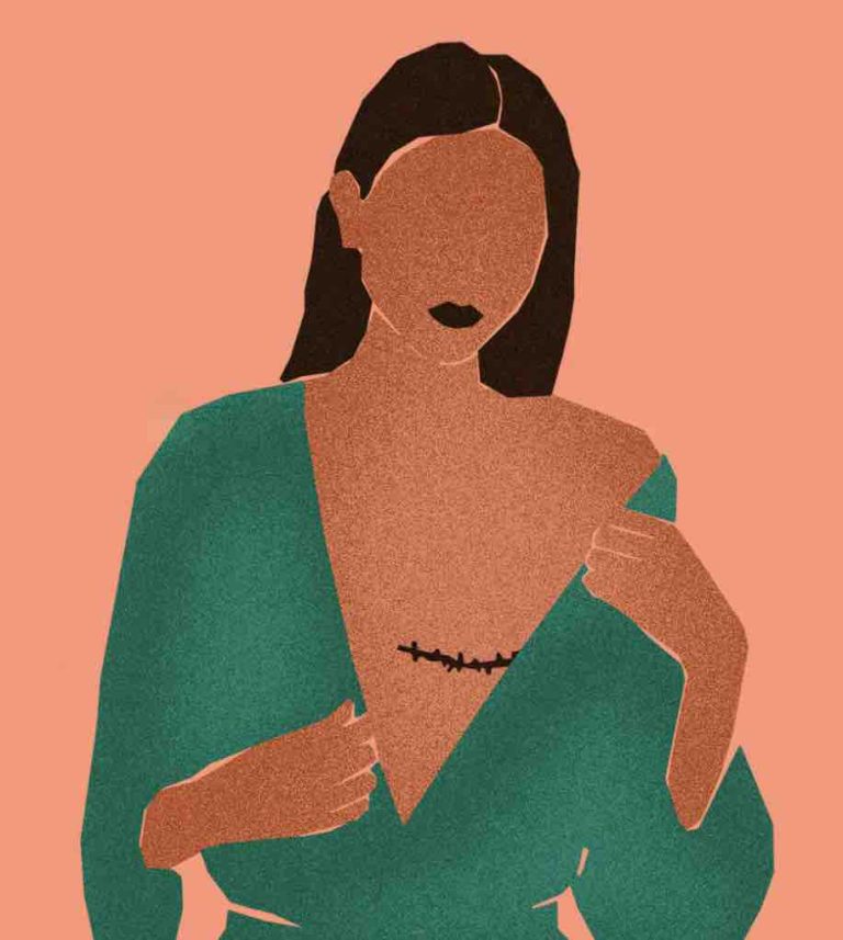 téva/ «Mes seins ne me tueront pas» : Marianne Tavennec, porteuse du gène BRCA à haut risque de développer un cancer du sein, partage son expérience personnelle